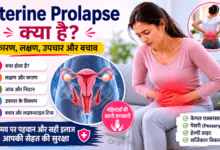 Uterine Prolapse (गर्भाशय प्रोलैप्स) के लक्षण, कारण, उपचार और बचाव की जानकारी