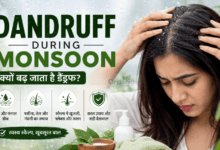 Dandruff during monsoon - मानसून में डैंड्रफ और स्कैल्प की खुजली से परेशान महिला।