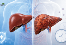 Hepatitis के लक्षण, प्रकार और बचाव के तरीके | AllWellHealthOrganic