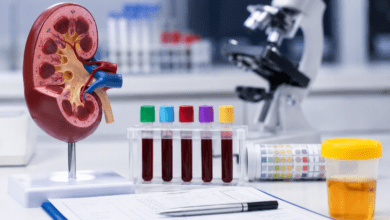 Kidney Function Test