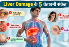 Liver Damage के शुरुआती लक्षण दिखाता हुआ मानव लिवर का मेडिकल चित्र