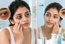 Dark Circles Under Eyes से परेशान भारतीय महिला अपनी आंखों के नीचे काले घेरों को देखते हुए