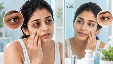 Dark Circles Under Eyes से परेशान भारतीय महिला अपनी आंखों के नीचे काले घेरों को देखते हुए