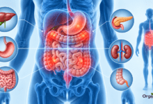 पेट दर्द (Abdominal Pain): कारण, लक्षण, इलाज और बचाव