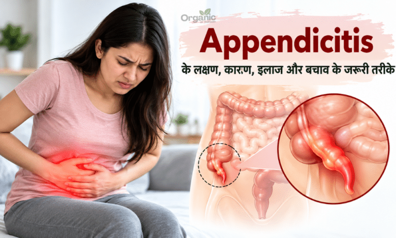 Appendicitis में पेट के निचले दाहिने हिस्से में स्थित अपेंडिक्स में सूजन का मेडिकल चित्रण।