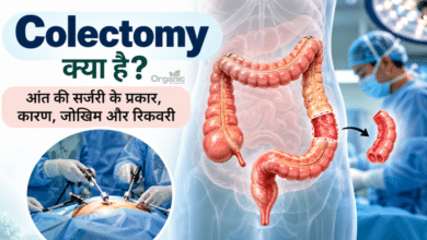 Colectomy सर्जरी में बड़ी आंत का प्रभावित हिस्सा निकालने की चिकित्सकीय प्रक्रिया का चित्र