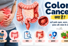 Colon Cancer के लक्षण, कारण, जांच और इलाज को दर्शाता मेडिकल हेल्थ इलस्ट्रेशन