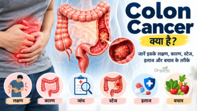 Colon Cancer के लक्षण, कारण, जांच और इलाज को दर्शाता मेडिकल हेल्थ इलस्ट्रेशन