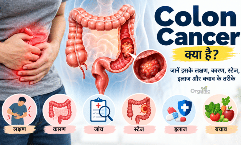 Colon Cancer के लक्षण, कारण, जांच और इलाज को दर्शाता मेडिकल हेल्थ इलस्ट्रेशन