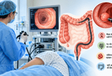 Colonoscopy प्रक्रिया में कैमरे वाली लचीली ट्यूब से बड़ी आंत की जांच करते डॉक्टर