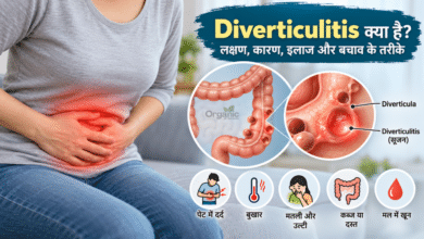 Diverticulitis को दर्शाता मेडिकल चित्र जिसमें बड़ी आंत की दीवार पर बनी छोटी थैलियों में सूजन दिखाई गई है।