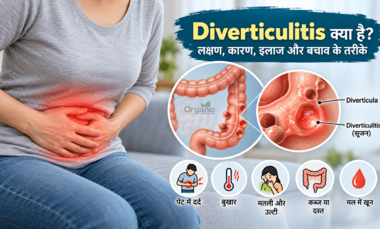 Diverticulitis को दर्शाता मेडिकल चित्र जिसमें बड़ी आंत की दीवार पर बनी छोटी थैलियों में सूजन दिखाई गई है।
