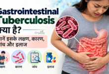Gastrointestinal Tuberculosis यानी आंतों की टीबी के लक्षण, जांच और इलाज की जानकारी