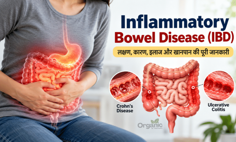 Inflammatory bowel disease (IBD) को समझाने वाला मानव पाचन तंत्र और बड़ी तथा छोटी आंत का मेडिकल चित्र।